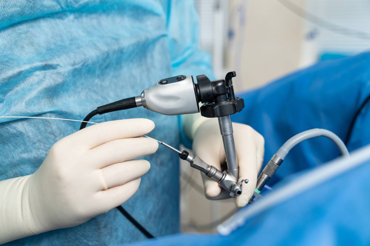 Types of Surgical Ablation - Mississippi Anesthesia Professionals